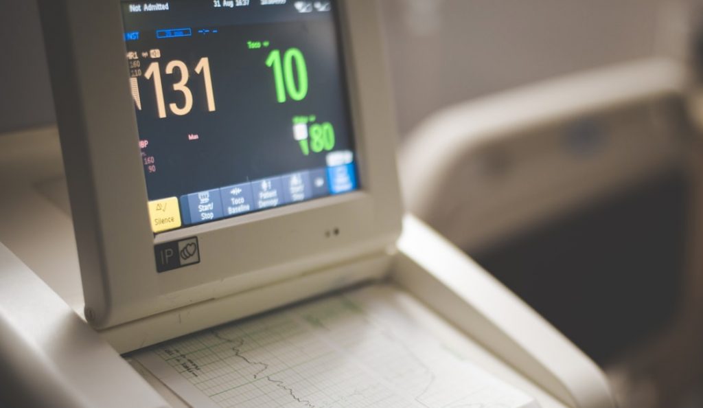 A EKG monitor